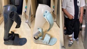 装具-アイキャッチ