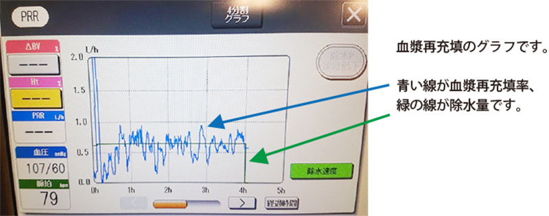 BV計を使用した除水管理