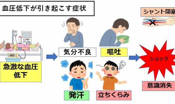 「ショック」ゼロ至適透析チーム