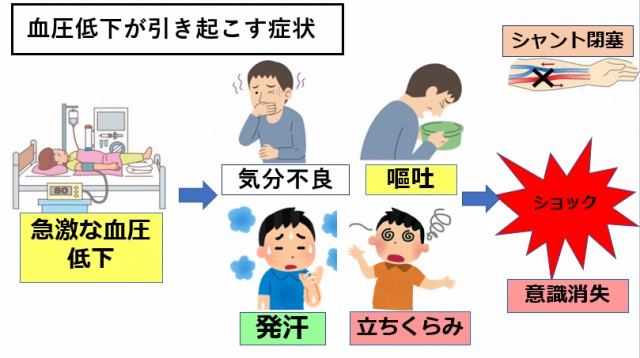 「ショック」ゼロ至適透析チーム