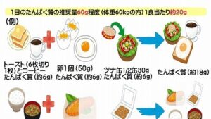 透析治療とサルコペニアサムネ