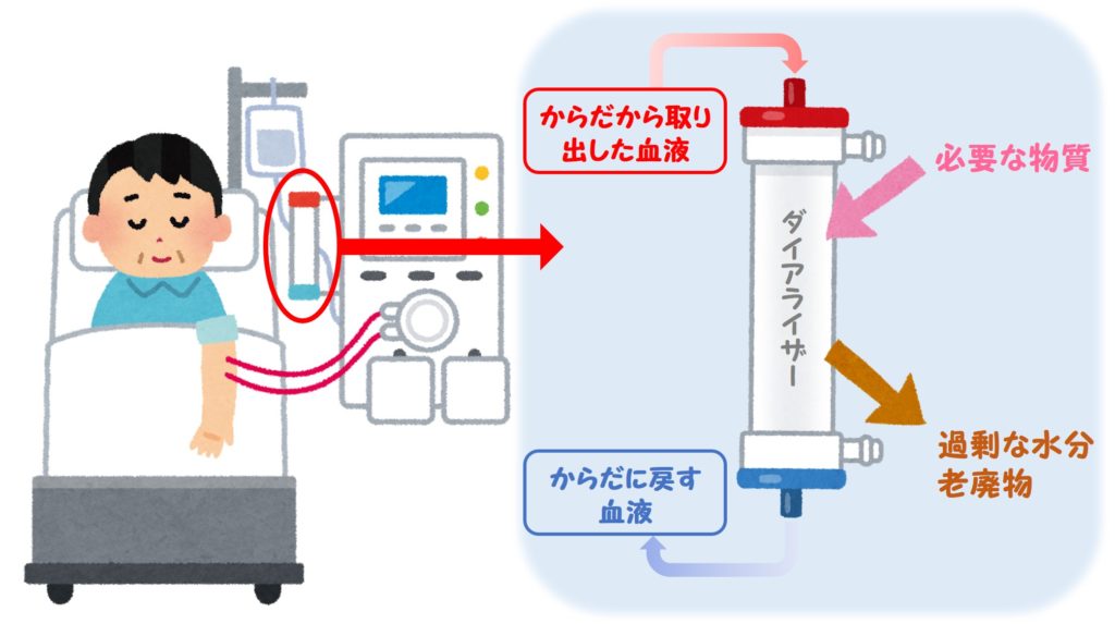 透析療法とは