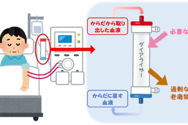 透析療法とは