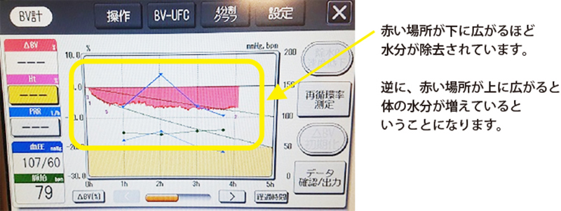 BV計を使用した除水管理