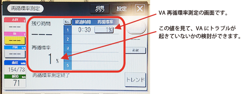 BV計を使用した除水管理